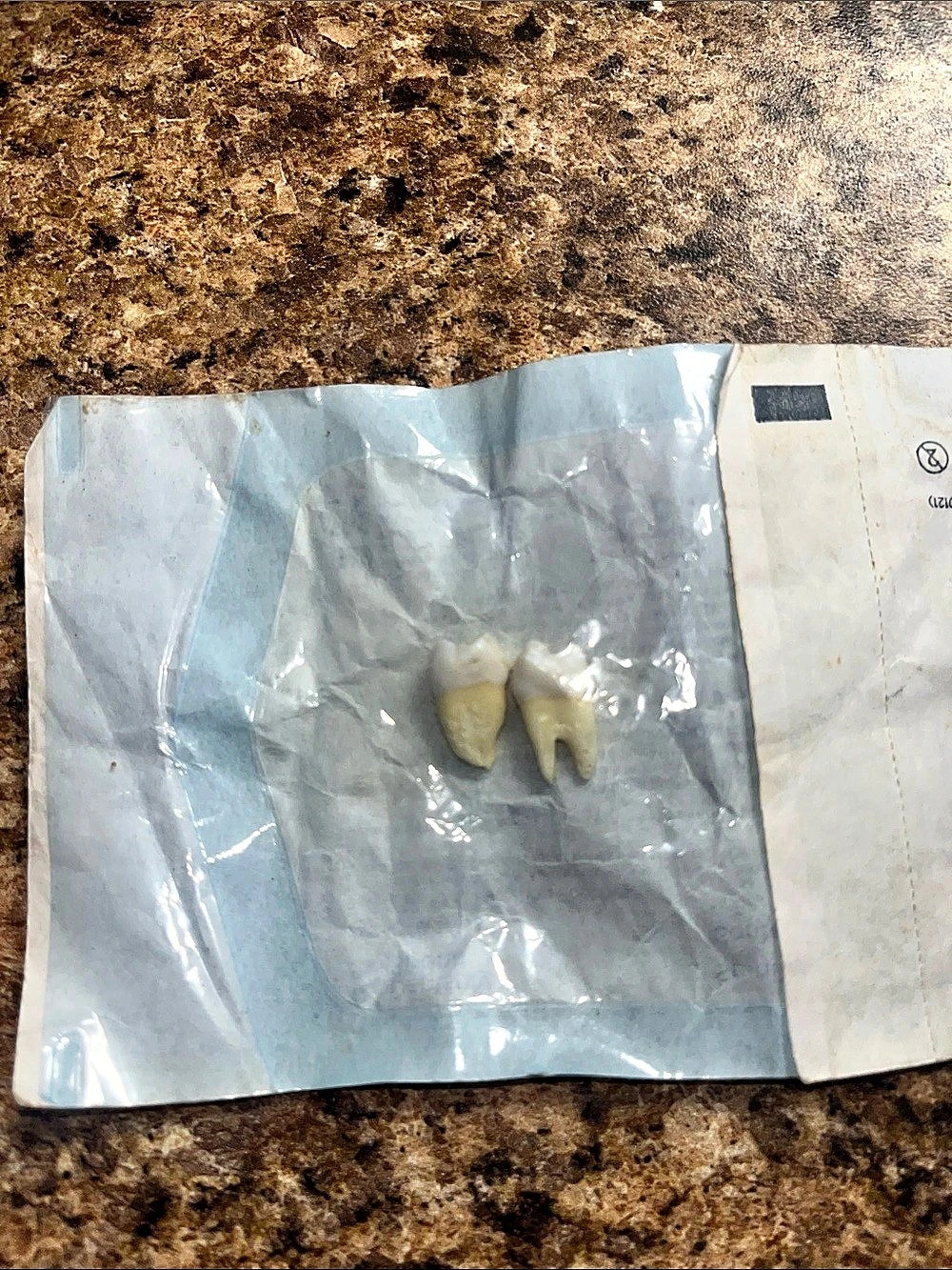 Wisdom teeth 🦷